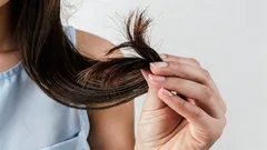 Dietologové: 4 stravovací návyky, které nevratně ničí vlasy